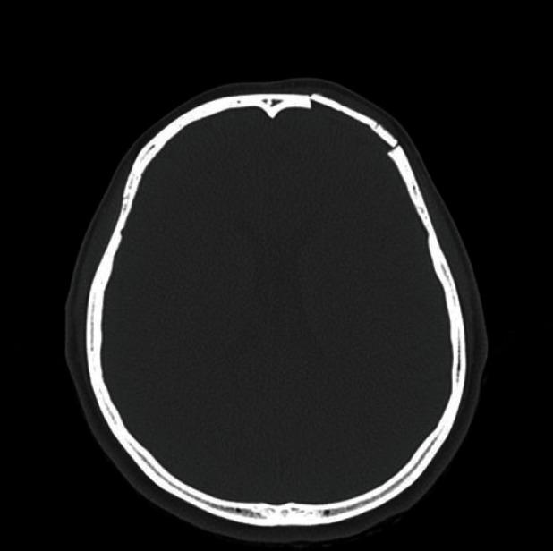 https://cdn.ncbi.nlm.nih.gov/pmc/blobs/ecf6/3665882/fb9c6f0d8018/aps-40-283-g005.jpg