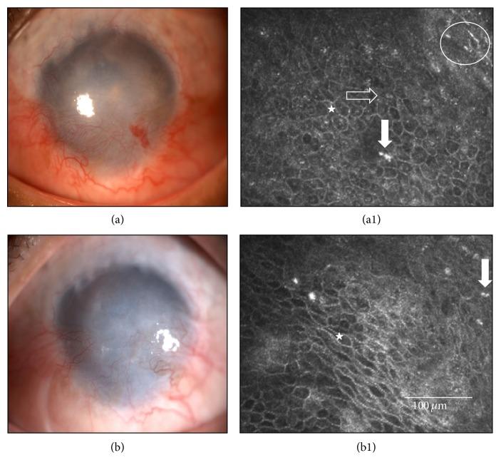 https://cdn.ncbi.nlm.nih.gov/pmc/blobs/ecf6/4588357/de2cac074ca8/BMRI2015-408495.003.jpg