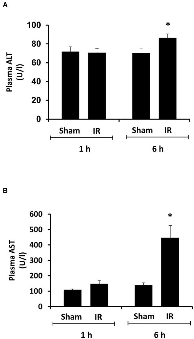 https://cdn.ncbi.nlm.nih.gov/pmc/blobs/ecf7/7280447/d12290b5d296/fmed-07-00201-g0003.jpg