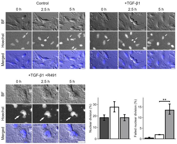 https://cdn.ncbi.nlm.nih.gov/pmc/blobs/ecf8/11720119/160e6df1105b/cancers-17-00081-g003.jpg