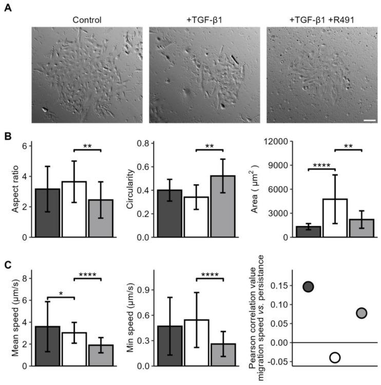 https://cdn.ncbi.nlm.nih.gov/pmc/blobs/ecf8/11720119/aca6d4461b63/cancers-17-00081-g002.jpg