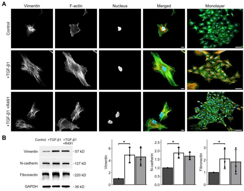 https://cdn.ncbi.nlm.nih.gov/pmc/blobs/ecf8/11720119/f34634620169/cancers-17-00081-g001.jpg