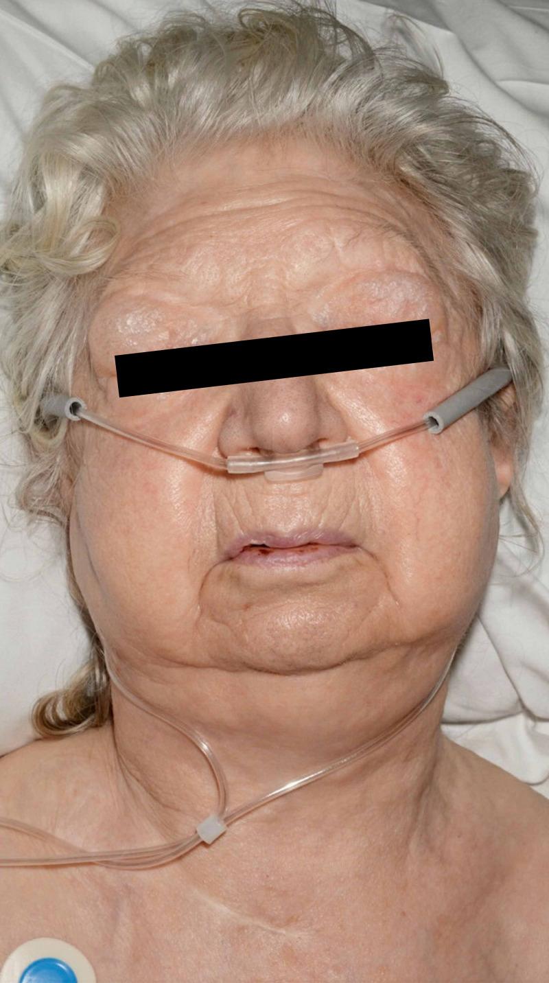 https://cdn.ncbi.nlm.nih.gov/pmc/blobs/ecfb/7925055/1b4e8cfa3c2d/cureus-0013-00000013051-i01.jpg