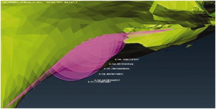 https://cdn.ncbi.nlm.nih.gov/pmc/blobs/ecfe/6011301/068873d1f9a6/10.1177_0300060517725973-fig4.jpg