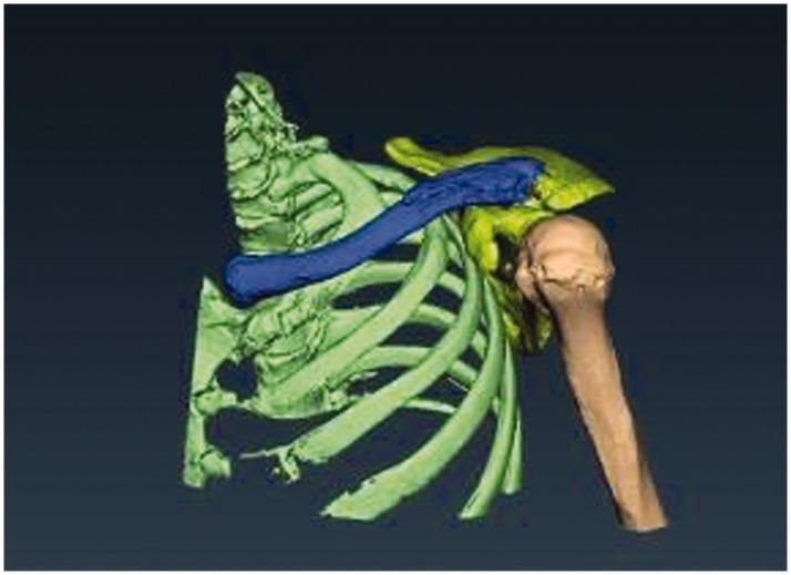 https://cdn.ncbi.nlm.nih.gov/pmc/blobs/ecfe/6011301/ce110994b03e/10.1177_0300060517725973-fig2.jpg