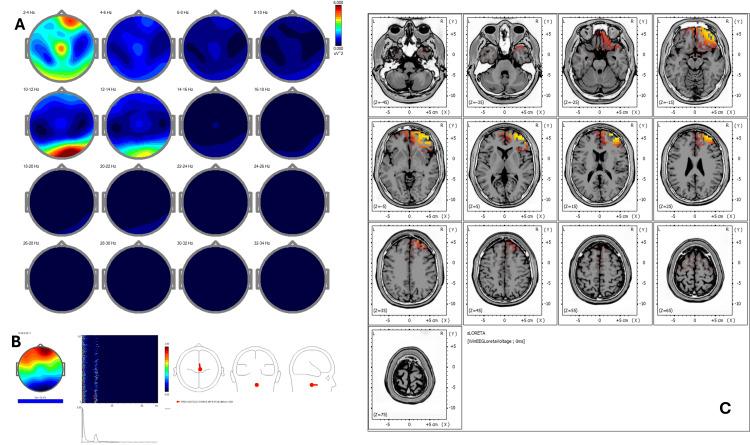 https://cdn.ncbi.nlm.nih.gov/pmc/blobs/ed06/12377494/5757975ce1ff/cureus-0017-00000090951-i08.jpg