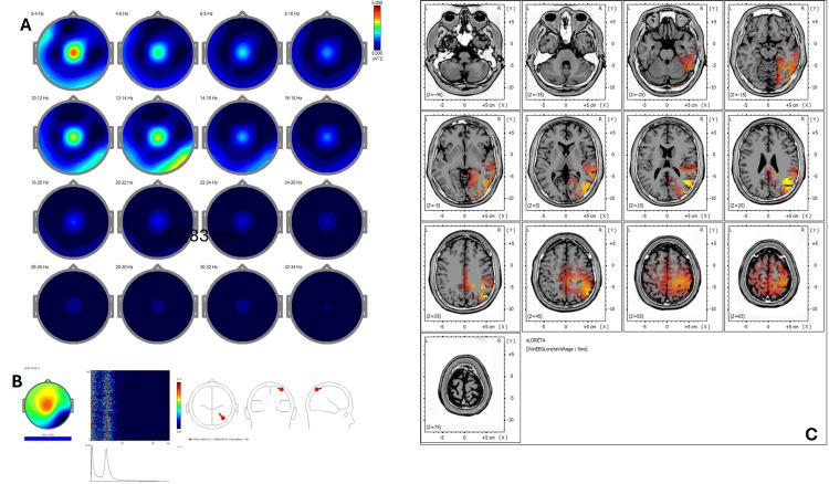 https://cdn.ncbi.nlm.nih.gov/pmc/blobs/ed06/12377494/7429d40a403e/cureus-0017-00000090951-i03.jpg