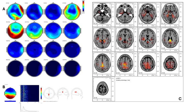 https://cdn.ncbi.nlm.nih.gov/pmc/blobs/ed06/12377494/758249071954/cureus-0017-00000090951-i02.jpg