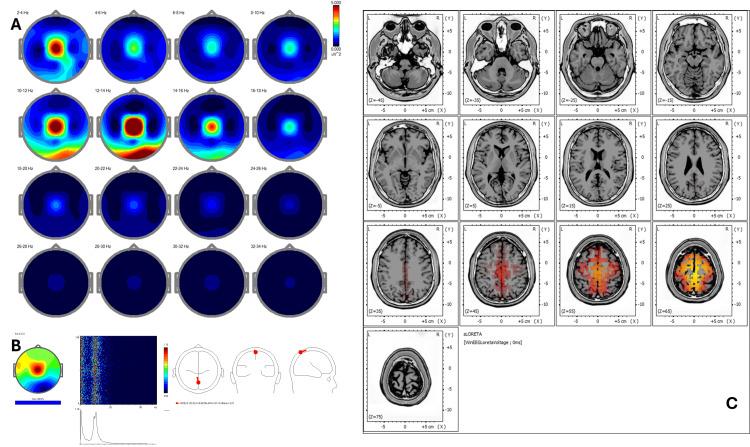 https://cdn.ncbi.nlm.nih.gov/pmc/blobs/ed06/12377494/8316c738dd04/cureus-0017-00000090951-i04.jpg
