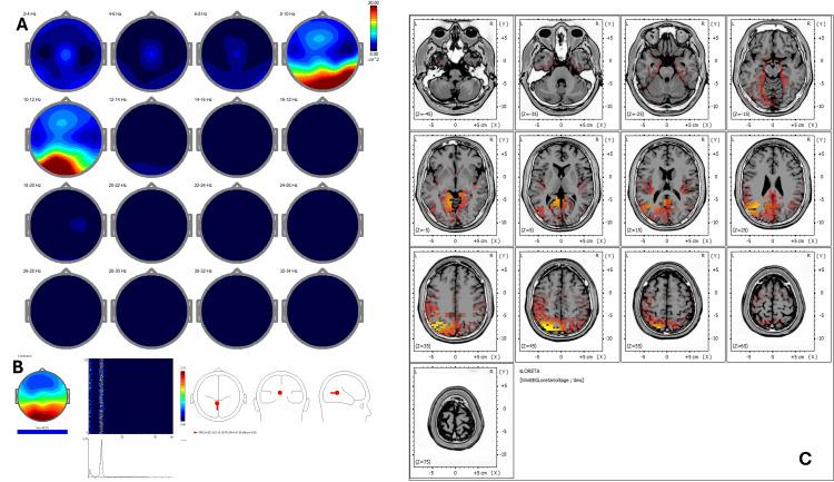 https://cdn.ncbi.nlm.nih.gov/pmc/blobs/ed06/12377494/a8540d6e43cd/cureus-0017-00000090951-i10.jpg