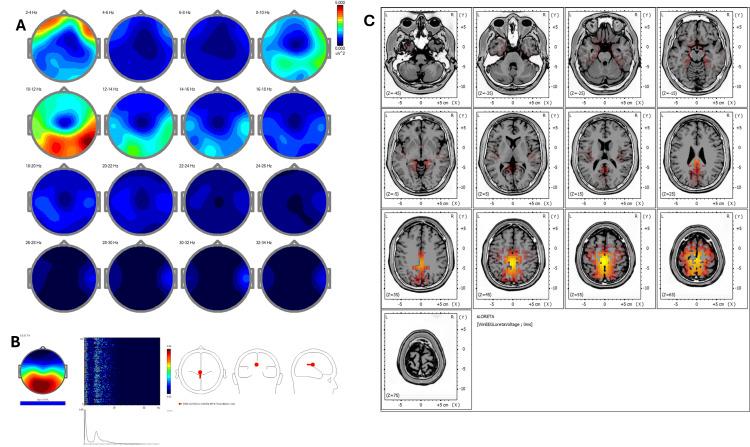 https://cdn.ncbi.nlm.nih.gov/pmc/blobs/ed06/12377494/a8aa639657f3/cureus-0017-00000090951-i01.jpg