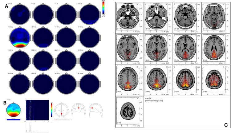 https://cdn.ncbi.nlm.nih.gov/pmc/blobs/ed06/12377494/d2855be6ac7f/cureus-0017-00000090951-i05.jpg