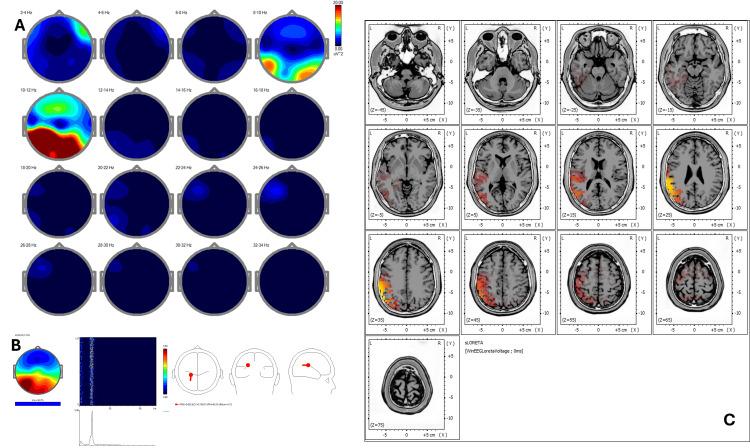https://cdn.ncbi.nlm.nih.gov/pmc/blobs/ed06/12377494/e712f441df32/cureus-0017-00000090951-i09.jpg