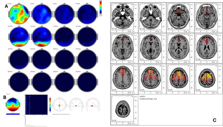 https://cdn.ncbi.nlm.nih.gov/pmc/blobs/ed06/12377494/fb7bc4a1af4f/cureus-0017-00000090951-i07.jpg
