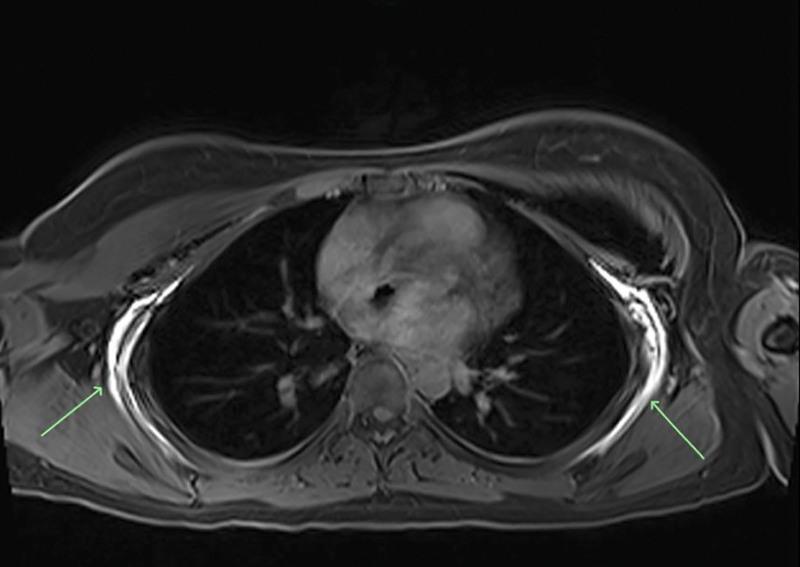 https://cdn.ncbi.nlm.nih.gov/pmc/blobs/ed06/9584193/504c81aaa971/gox-10-e4584-g004.jpg