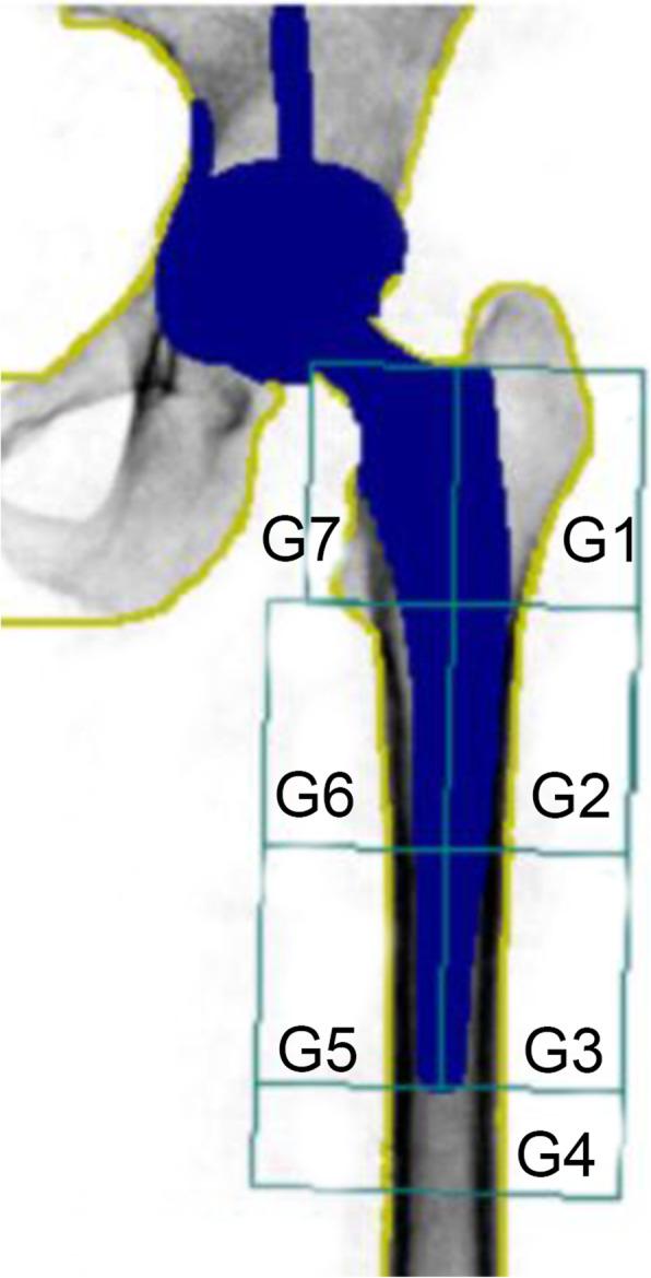 https://cdn.ncbi.nlm.nih.gov/pmc/blobs/ed0a/7607681/bf36f6eff1cd/13018_2020_2034_Fig1_HTML.jpg