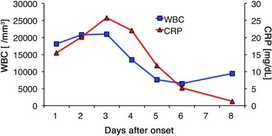 https://cdn.ncbi.nlm.nih.gov/pmc/blobs/ed0c/4711340/9ad41fe12f81/eplasty16e02_fig4.jpg