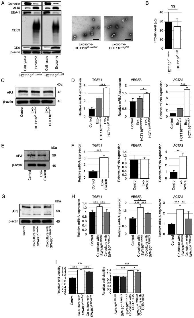 https://cdn.ncbi.nlm.nih.gov/pmc/blobs/ed17/10631769/bf1f543bf1b2/ijo-63-06-05587-g04.jpg