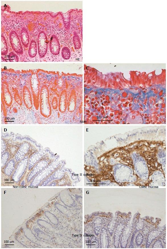 https://cdn.ncbi.nlm.nih.gov/pmc/blobs/ed18/5340810/6adf09298eb6/WJG-23-1586-g004.jpg
