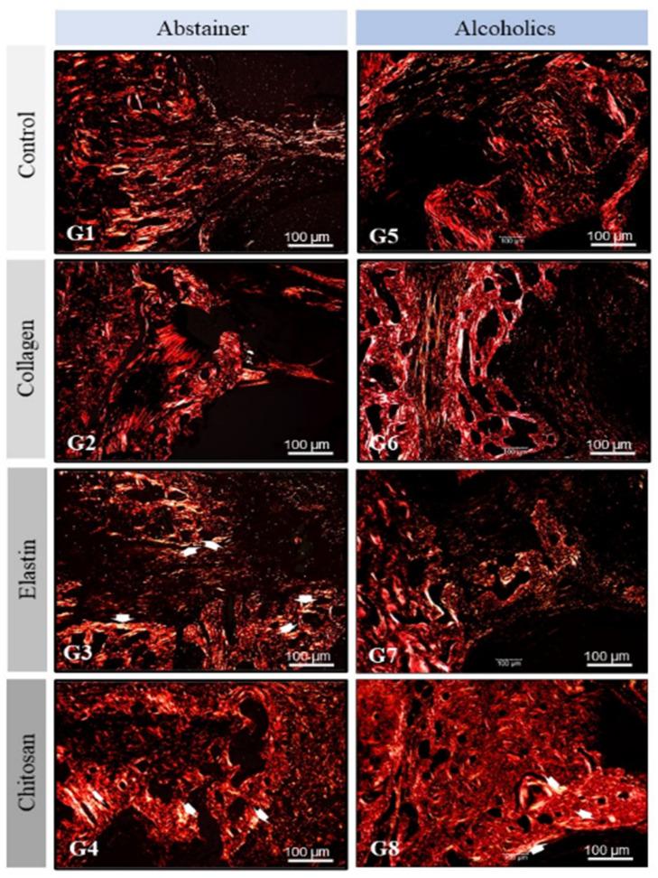 https://cdn.ncbi.nlm.nih.gov/pmc/blobs/ed19/8747723/20e02efd5474/polymers-14-00188-g005.jpg