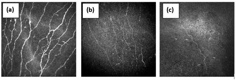 https://cdn.ncbi.nlm.nih.gov/pmc/blobs/ed1d/8954271/a03b0ef27135/pathophysiology-29-00001-g002.jpg
