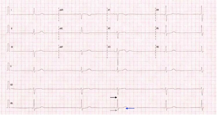 https://cdn.ncbi.nlm.nih.gov/pmc/blobs/ed1f/10979516/fdde8491e8e2/cureus-0016-00000055127-i01.jpg