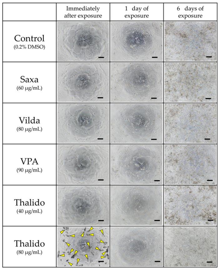 https://cdn.ncbi.nlm.nih.gov/pmc/blobs/ed1f/11817626/4eeaeb771dfb/cells-14-00215-g005.jpg