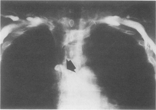 https://cdn.ncbi.nlm.nih.gov/pmc/blobs/ed26/1250738/3fa2f19ce719/annsurg00110-0100-b.jpg