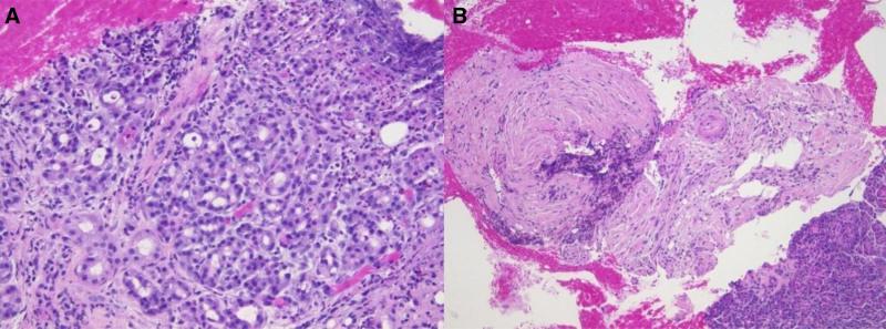 https://cdn.ncbi.nlm.nih.gov/pmc/blobs/ed27/12263024/ec3eb2310e6e/medi-104-e43359-g004.jpg
