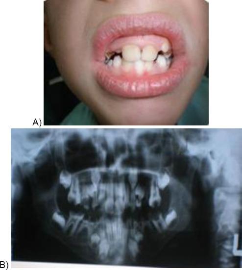 https://cdn.ncbi.nlm.nih.gov/pmc/blobs/ed33/5985881/3ff783847ab0/OAMJMS-6-867-g001.jpg