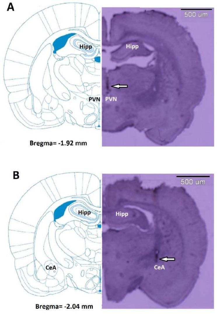 https://cdn.ncbi.nlm.nih.gov/pmc/blobs/ed3a/8114857/2d37a113bd52/BCN-12-133-g002.jpg