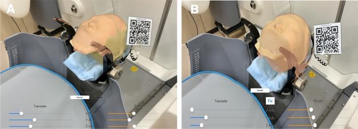 https://cdn.ncbi.nlm.nih.gov/pmc/blobs/ed3b/8927150/b93006043c95/41598_2022_8390_Fig1_HTML.jpg