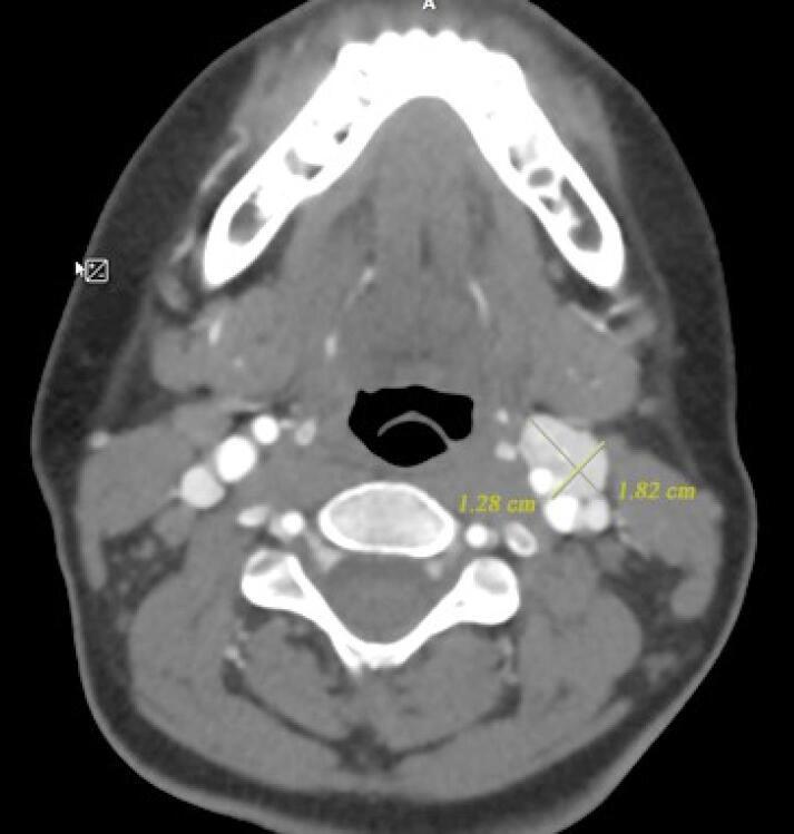 https://cdn.ncbi.nlm.nih.gov/pmc/blobs/ed3d/11416696/03bc90f32d30/aim-27-447-g003.jpg