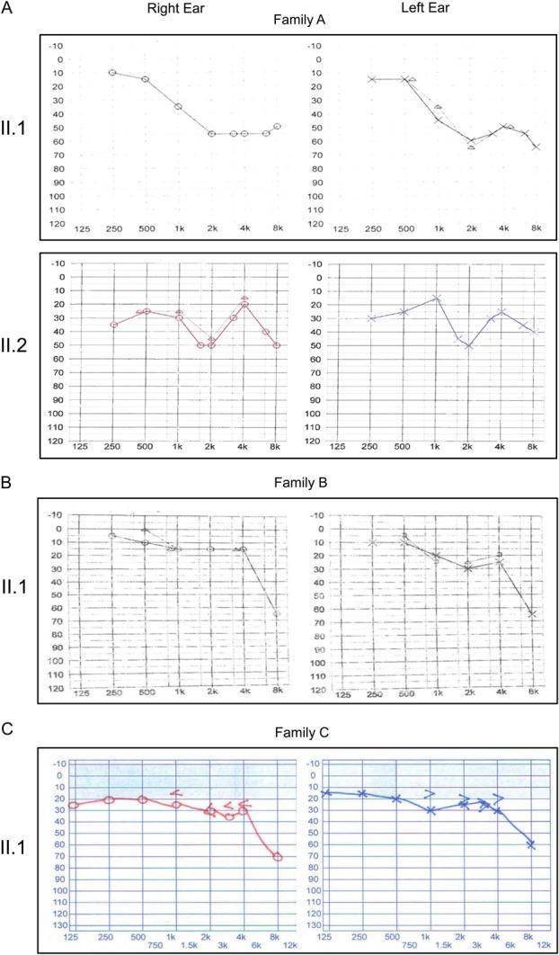 https://cdn.ncbi.nlm.nih.gov/pmc/blobs/ed3e/4195577/dfd21d2c0a95/cornea-33-247-g002.jpg