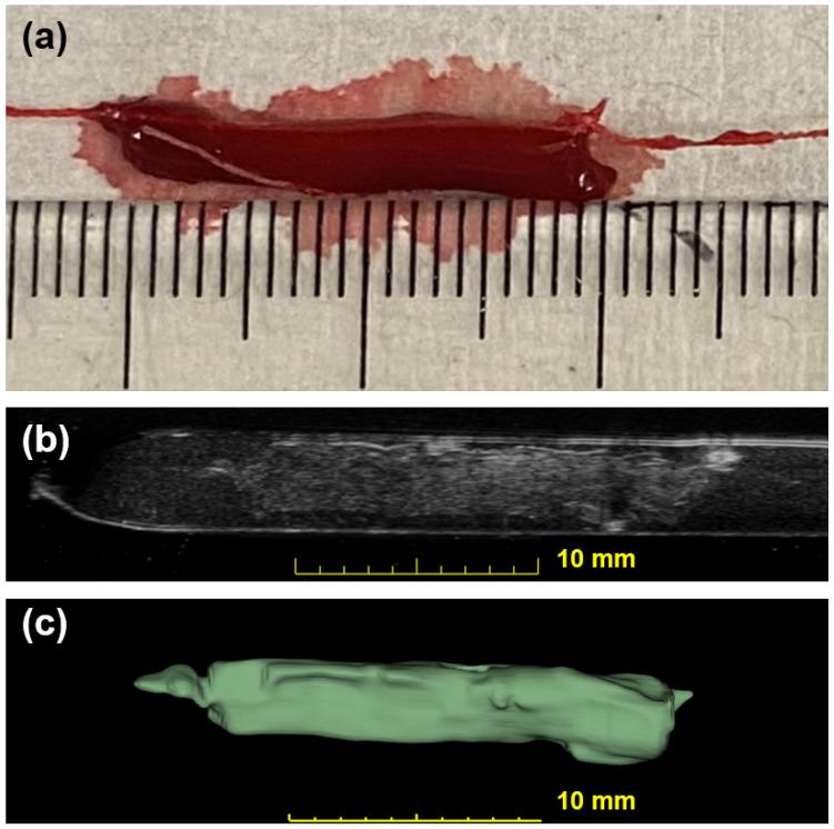 https://cdn.ncbi.nlm.nih.gov/pmc/blobs/ed3f/11154521/e200baf6cf8f/biomedicines-12-00200-g004.jpg