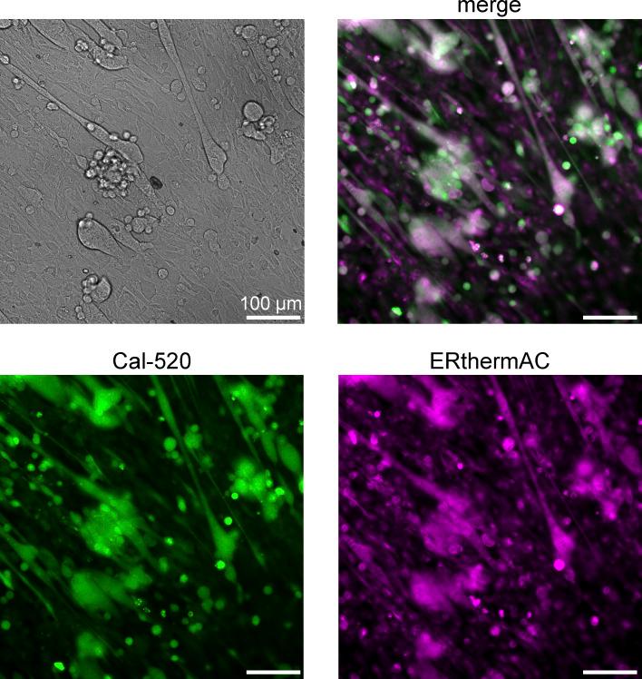 https://cdn.ncbi.nlm.nih.gov/pmc/blobs/ed41/9546722/8a8a6cba026d/JGP_202213136_FigS6.jpg