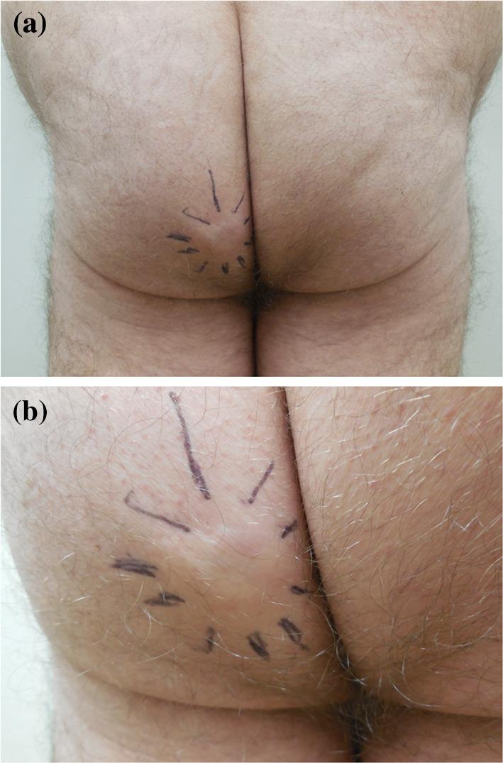 https://cdn.ncbi.nlm.nih.gov/pmc/blobs/ed42/4470960/8117c8aeda50/13555_2015_74_Fig1_HTML.jpg
