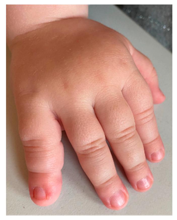 https://cdn.ncbi.nlm.nih.gov/pmc/blobs/ed43/11274991/5b5a8c691e68/children-11-00753-g001.jpg