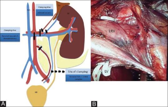 https://cdn.ncbi.nlm.nih.gov/pmc/blobs/ed44/4247506/2d4d663a511c/IJRI-24-367-g002.jpg
