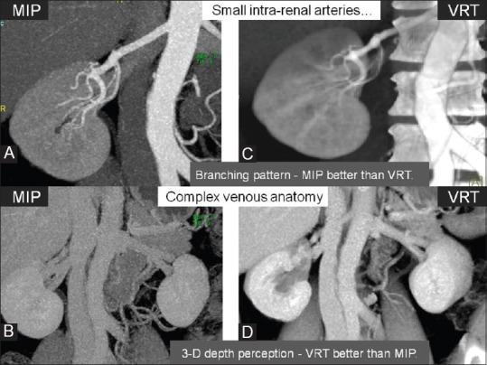 https://cdn.ncbi.nlm.nih.gov/pmc/blobs/ed44/4247506/c1ade1225f5e/IJRI-24-367-g005.jpg