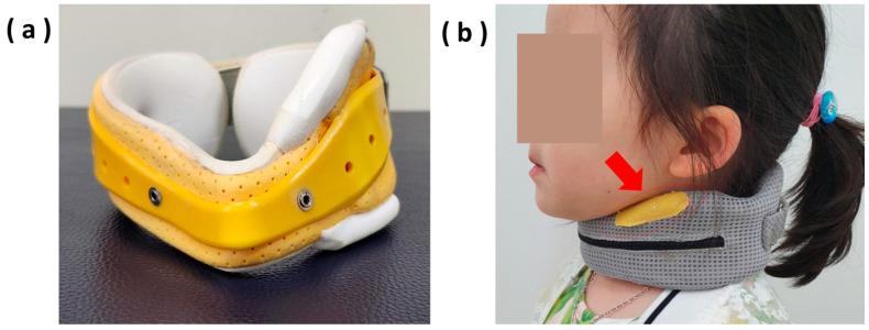 https://cdn.ncbi.nlm.nih.gov/pmc/blobs/ed48/11353172/32e9bb2057a4/children-11-01001-g001.jpg