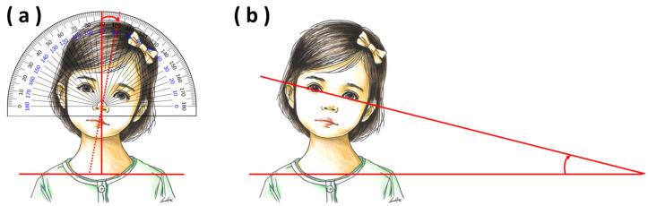 https://cdn.ncbi.nlm.nih.gov/pmc/blobs/ed48/11353172/eec9a1bef299/children-11-01001-g003.jpg