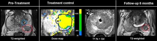 https://cdn.ncbi.nlm.nih.gov/pmc/blobs/ed4c/10464407/7a37ab5a5c36/12894_2023_1306_Fig1_HTML.jpg