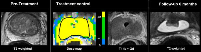 https://cdn.ncbi.nlm.nih.gov/pmc/blobs/ed4c/10464407/bc6d6d84bbc9/12894_2023_1306_Fig2_HTML.jpg