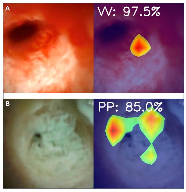 https://cdn.ncbi.nlm.nih.gov/pmc/blobs/ed4f/10571941/03699df0ca16/cancers-15-04827-g004.jpg