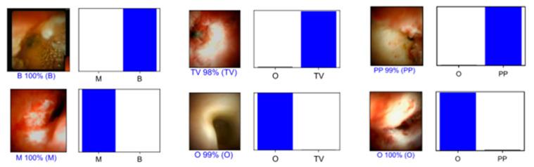 https://cdn.ncbi.nlm.nih.gov/pmc/blobs/ed4f/10571941/f064fddf4ec8/cancers-15-04827-g002.jpg