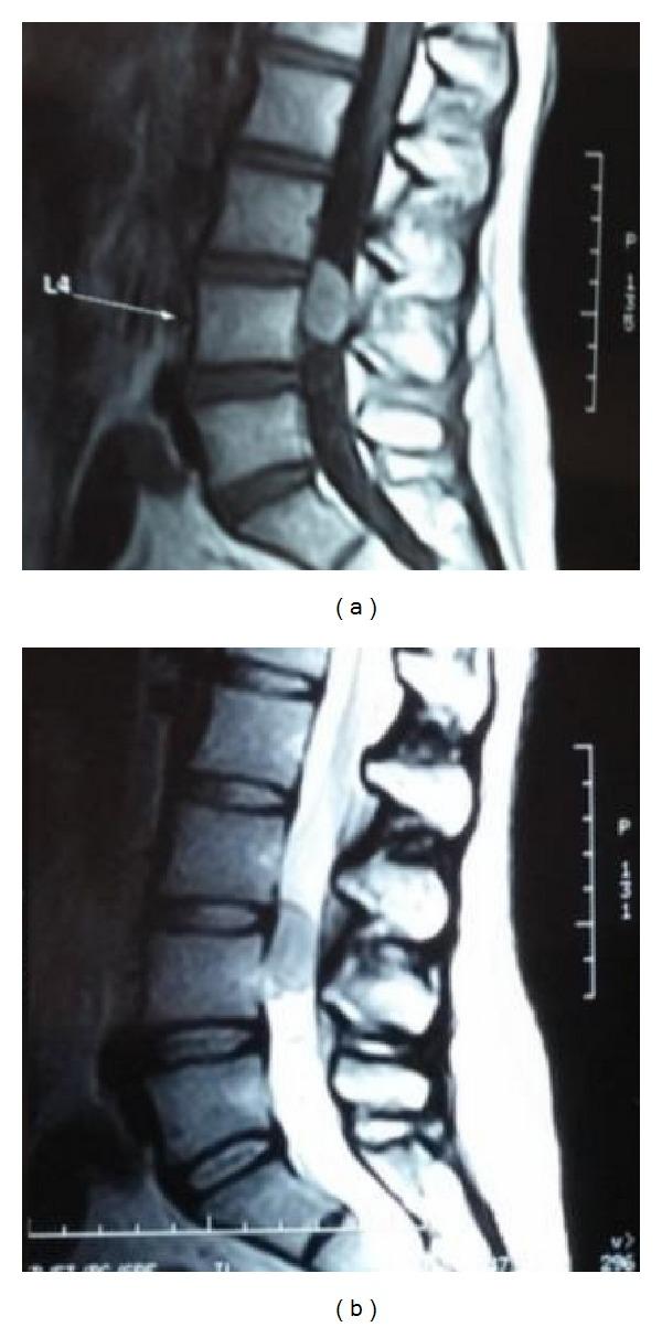 https://cdn.ncbi.nlm.nih.gov/pmc/blobs/ed52/4119904/1fcf28c94da7/CRIOR2014-852830.001.jpg