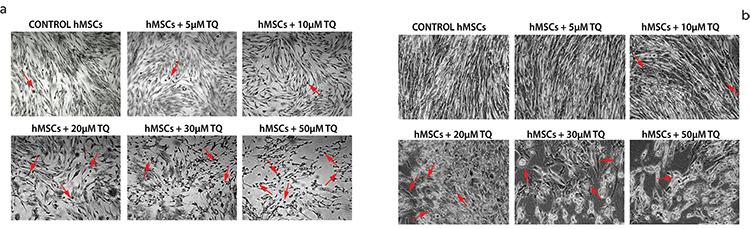 https://cdn.ncbi.nlm.nih.gov/pmc/blobs/ed56/8939446/7a81fd893412/medj-37-1-g7.jpg
