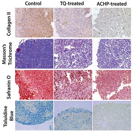 https://cdn.ncbi.nlm.nih.gov/pmc/blobs/ed56/8939446/8566260d3b43/medj-37-1-g9.jpg
