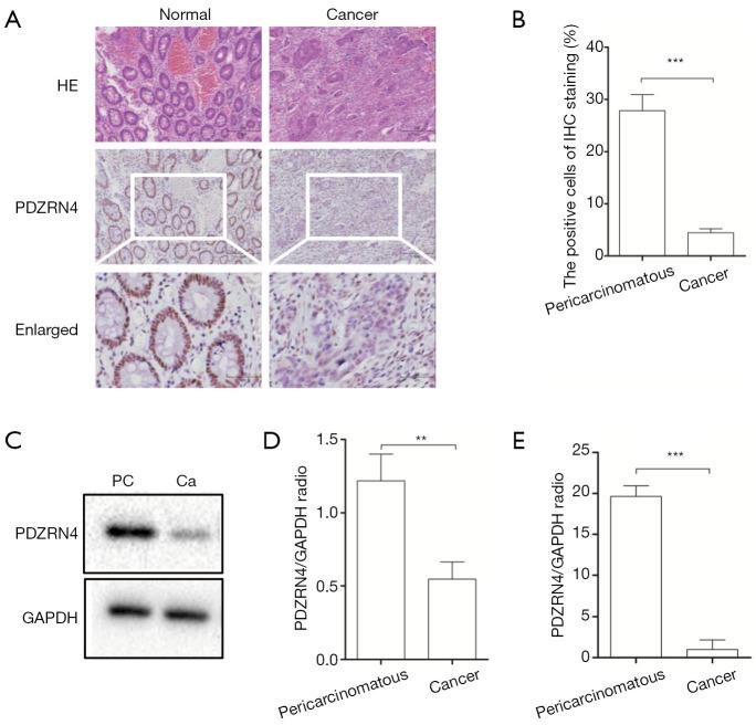 https://cdn.ncbi.nlm.nih.gov/pmc/blobs/ed58/8798939/6e8972a7045a/tcr-08-04-1289-f1.jpg